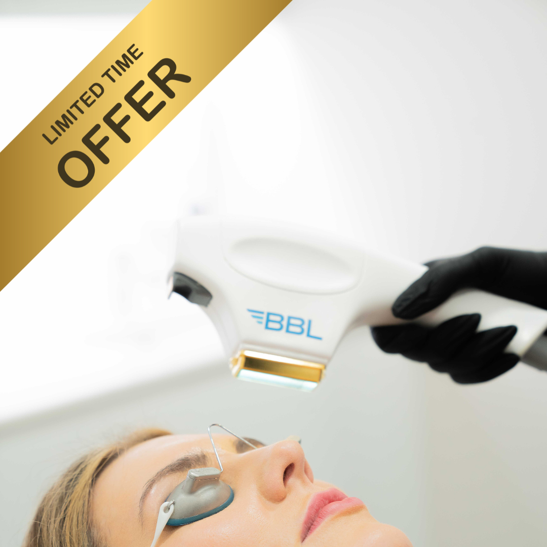 20% OFF 3x sessions BBL (Face only)