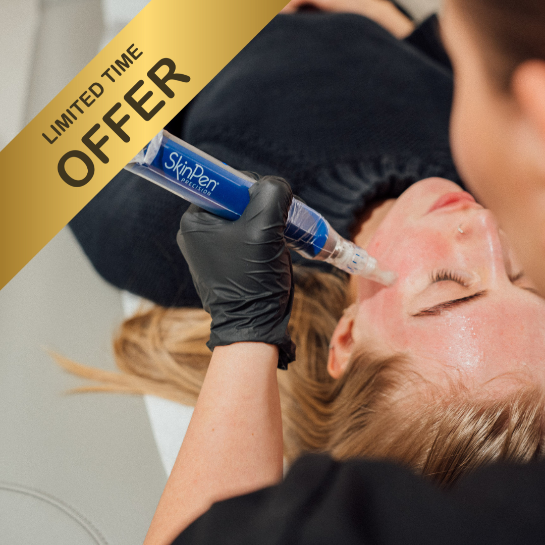 20% OFF 3x Sessions of Microneedling with Exosomes